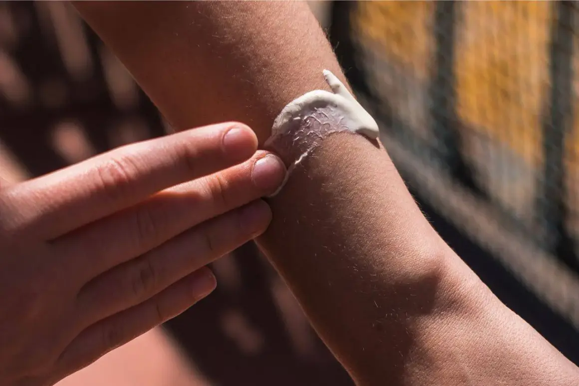Eine Hand verteilt Sonnencreme auf einem Arm. Hilft Sonnencreme gegen Pickel? Die Haut wird geschützt.