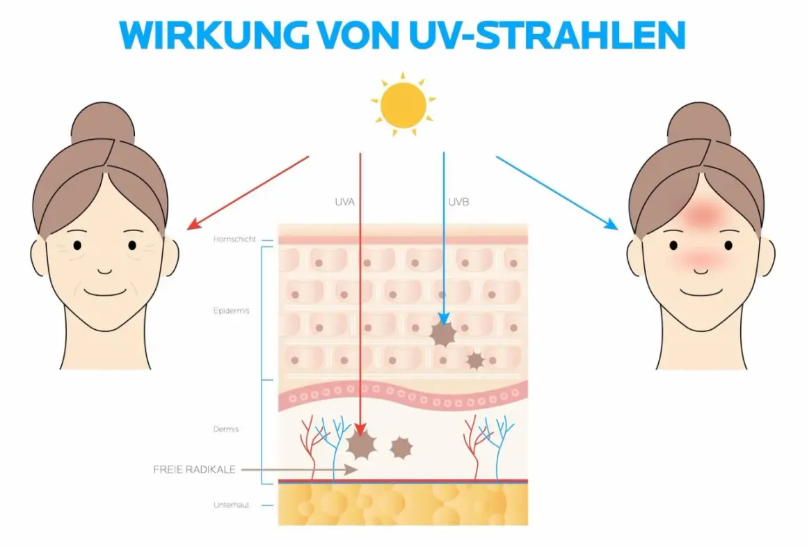 Illustration zeigt, wie UVA und UVB-Strahlen die Haut schädigen. Sonnencreme schützt vor diesen Strahlen.