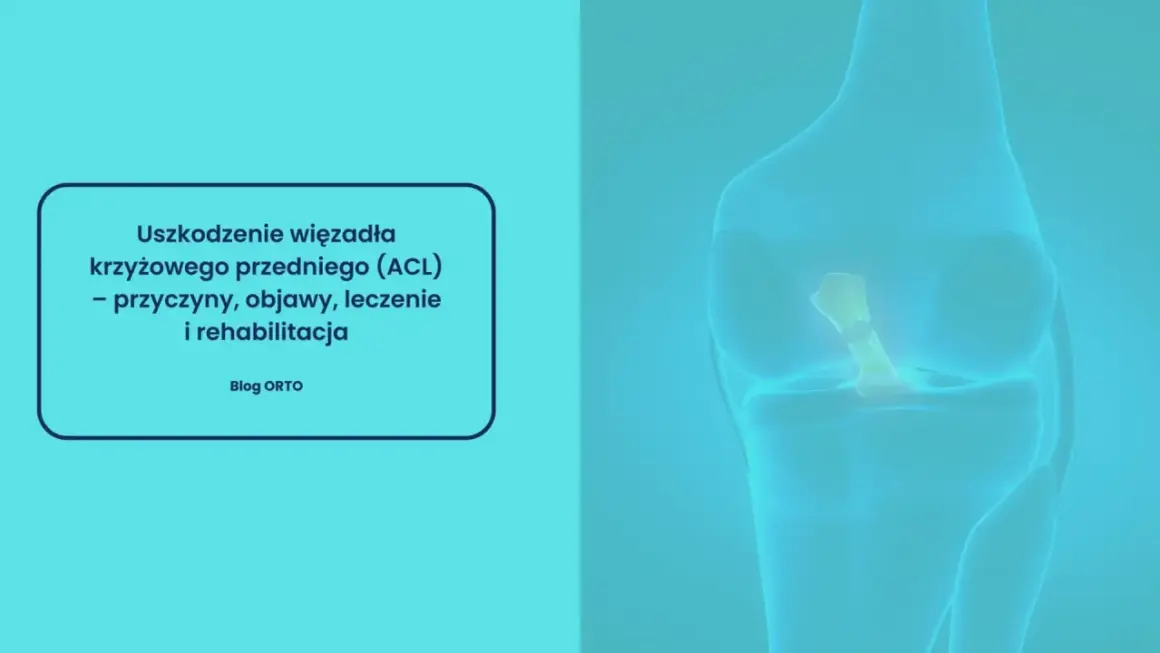 Anatomia kolana z widocznym uszkodzonym więzadłem krzyżowym przednim (ACL). Tekst informuje o przyczynach, objawach, leczeniu i rehabilitacji.