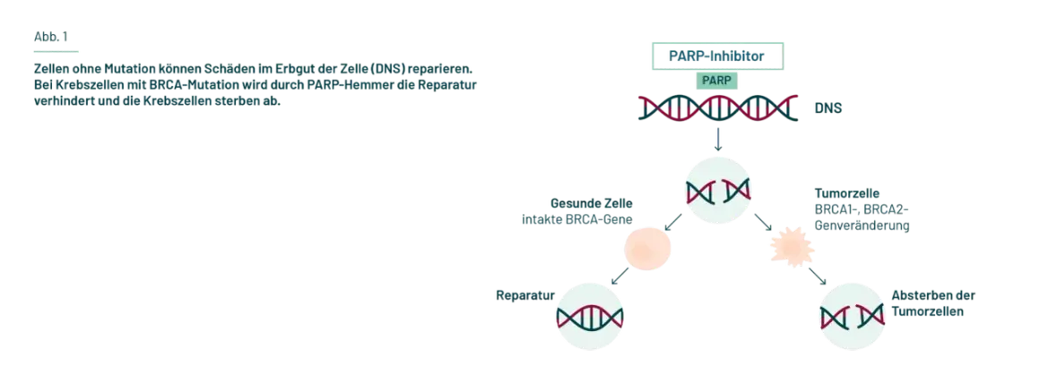 PARP-Inhibitoren blockieren die Reparatur von DNS-Schäden in Krebszellen mit BRCA-Mutation, was zu deren Absterben führt. Erste parp-inhibitor erfahrungsberichte zeigen Erfolge.