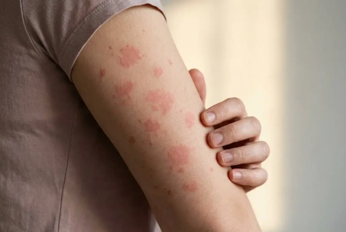 Haut rot aber kein Sonnenbrand: rote Flecken auf dem Arm, die jucken könnten.