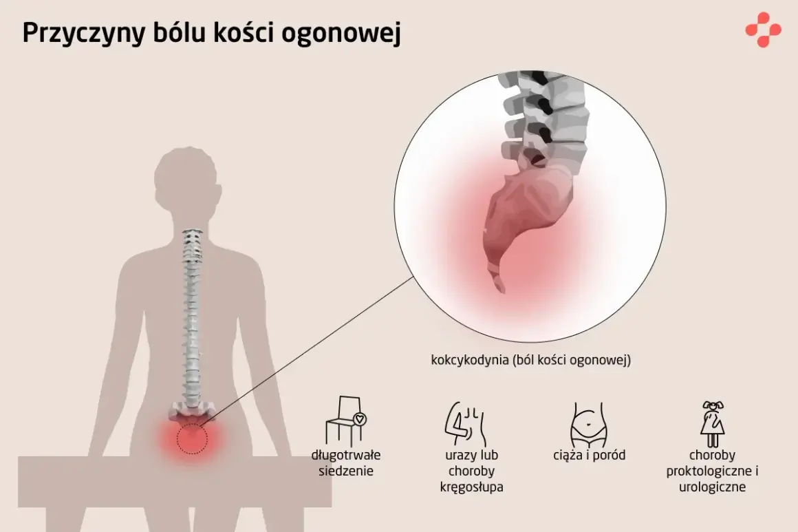 Ból kości ogonowej (kokcygodynia) może być spowodowany długotrwałym siedzeniem, urazami kręgosłupa, ciążą i porodem lub chorobami proktologicznymi.