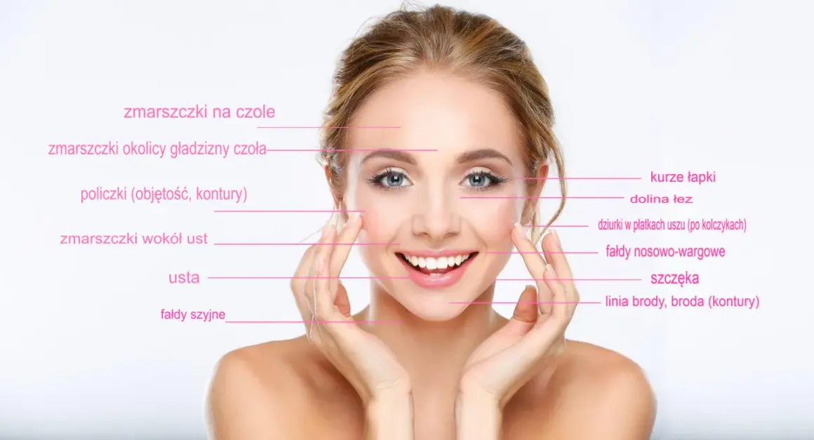 Uśmiechnięta kobieta z zaznaczonymi obszarami twarzy, gdzie można zastosować botox lub kwas hialuronowy na zmarszczki palacza i inne niedoskonałości.