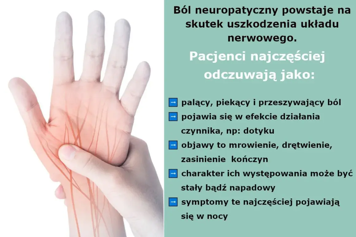 Dłoń z zaznaczonymi nerwami, ilustrująca ból neuropatyczny. Odczuwany jako pieczenie, mrowienie, drętwienie, nasilający się w nocy.