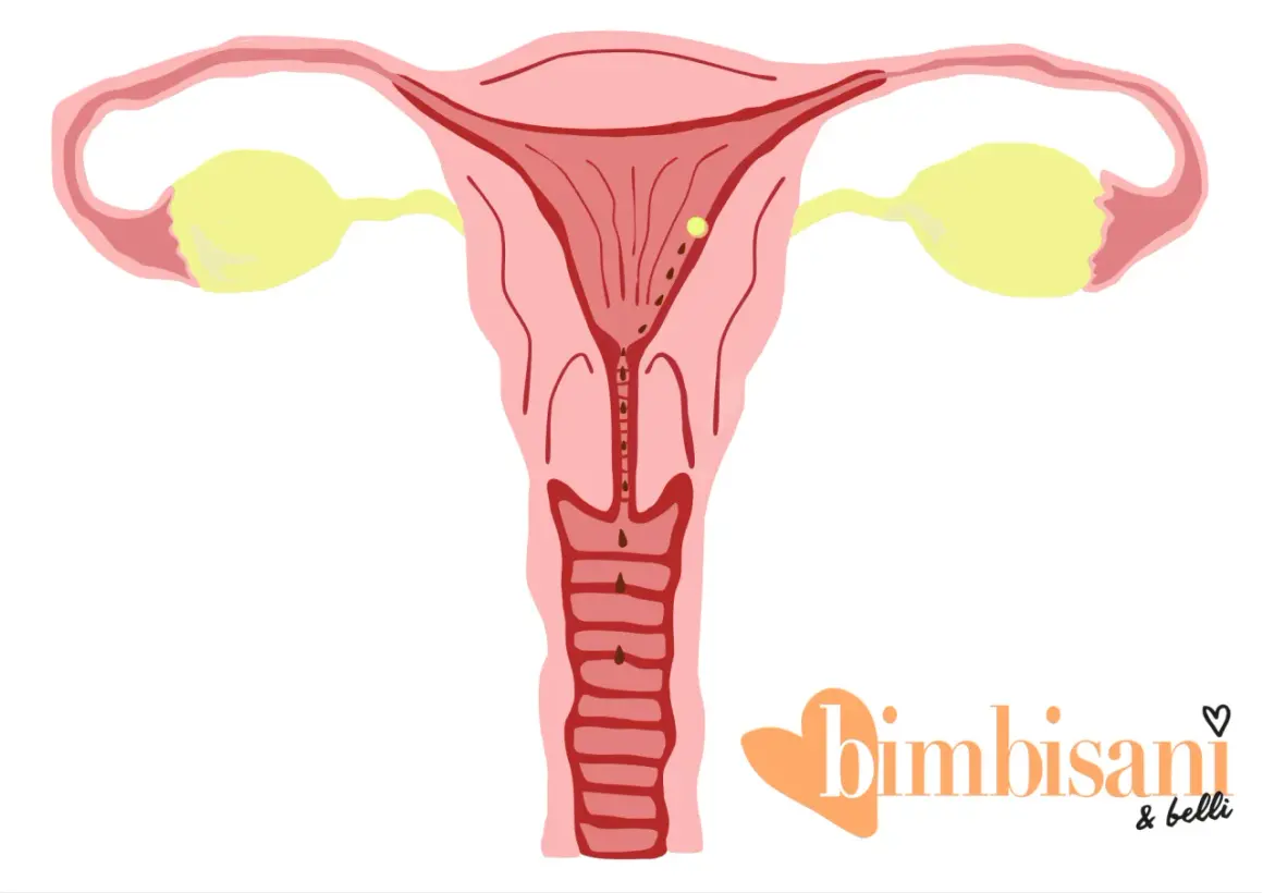 Illustrazione anatomica dell'utero con dettagli che suggeriscono immagini falso ciclo.