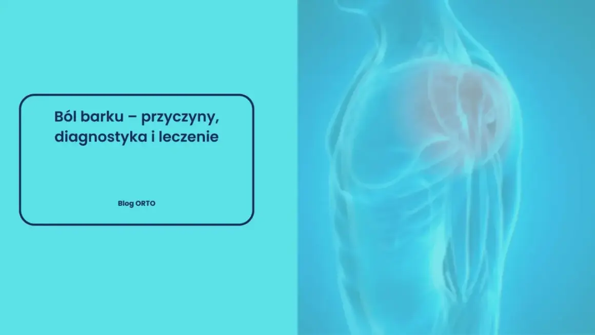 Ból barku – przyczyny, diagnostyka i leczenie. Grafika przedstawia ludzki bark z widocznymi strukturami anatomicznymi.