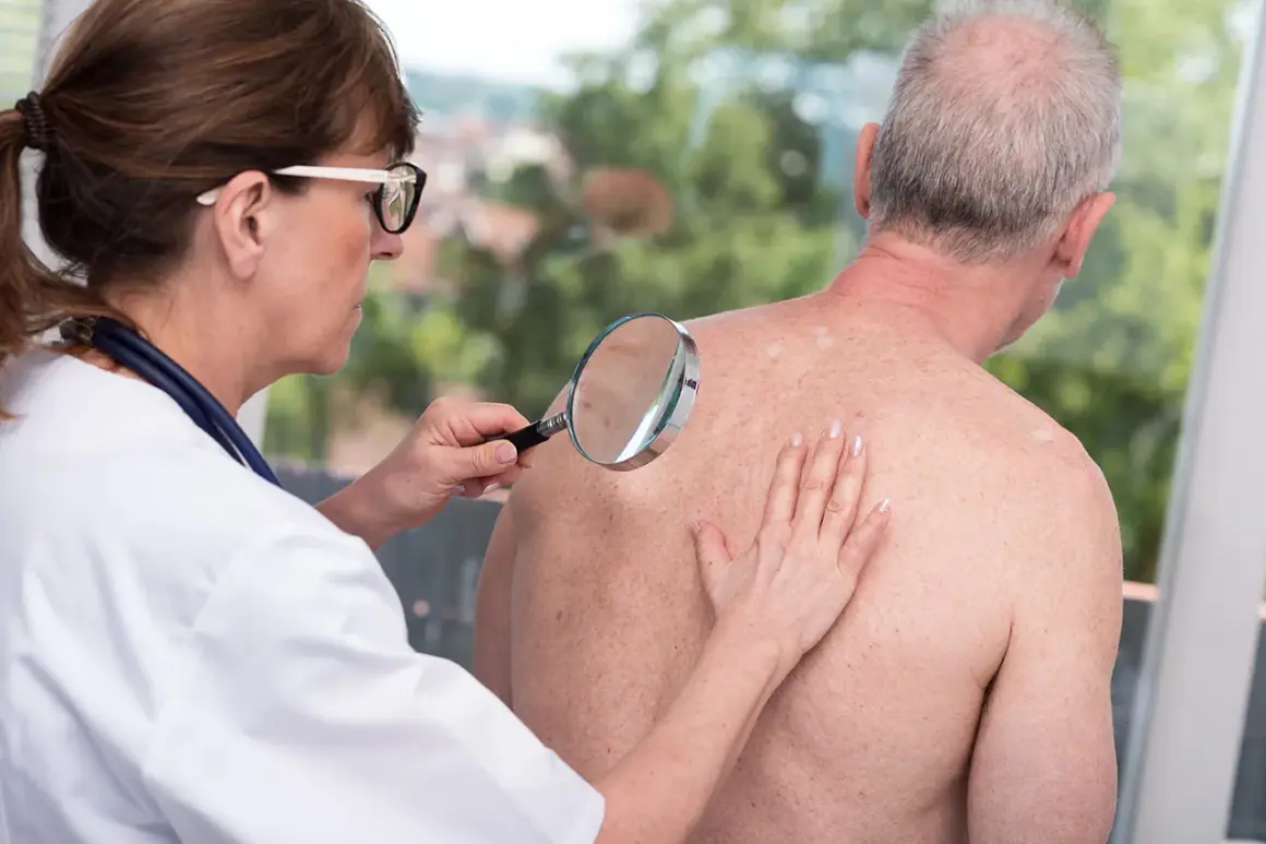 Ärztin untersucht Hautveränderungen, die auf Morbus Bowen hindeuten könnten, mit einer Lupe am Rücken eines Patienten.