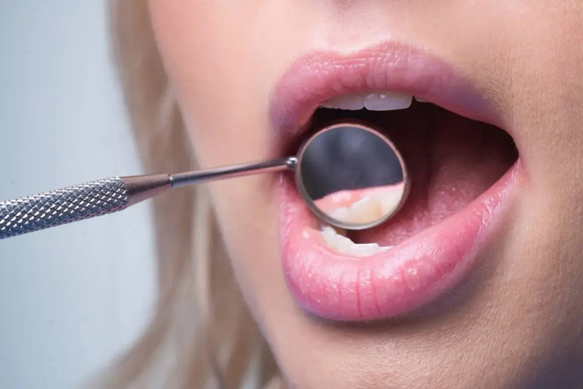 Usta kobiety z lusterkiem dentystycznym badającym zęby. Dowiedz się, jaka jest leczenie odwapnienia zębów cena.
