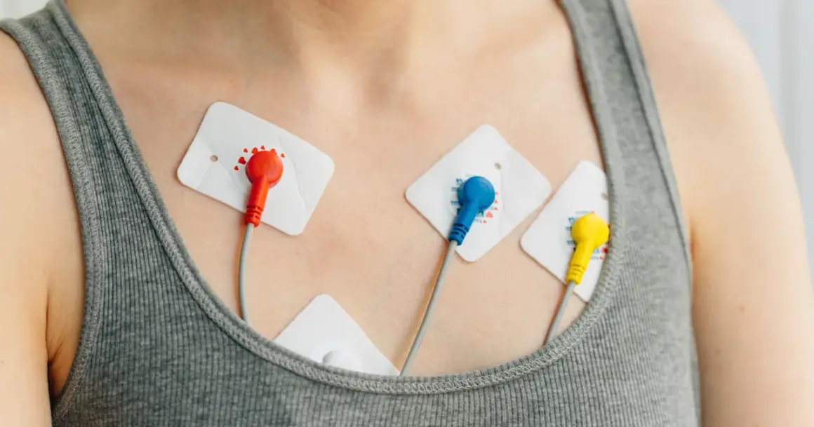Elektrody EKG na klatce piersiowej, monitorujące pracę serca w celu wykrycia arytmii.