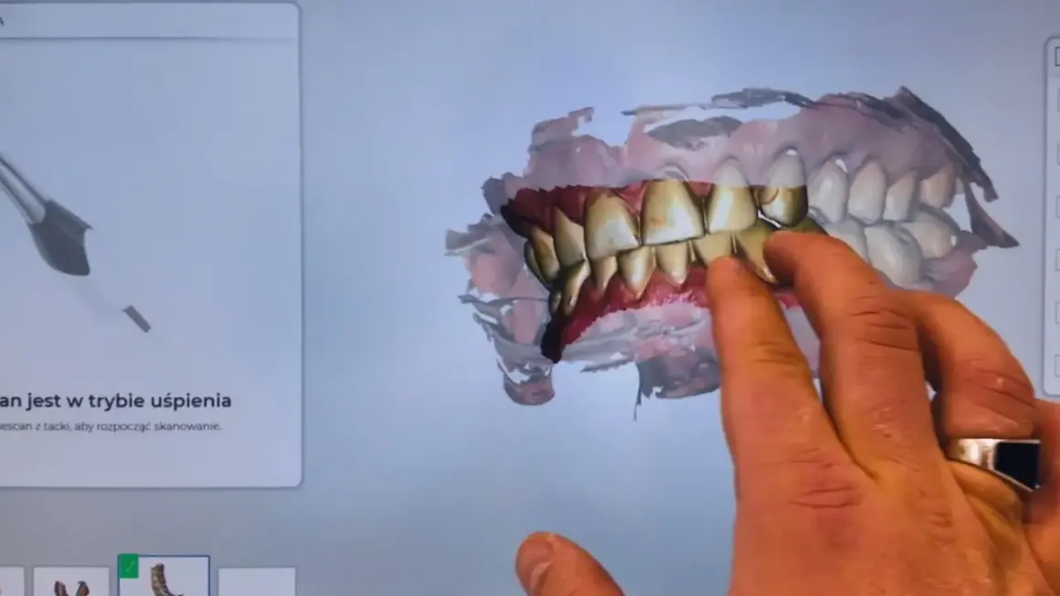 Co dentysta widzi? Więcej niż myślisz - poznaj prawdę