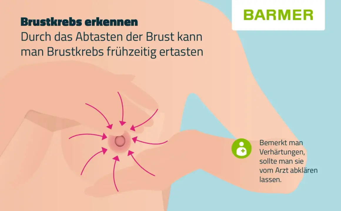 Brustkrebs erkennen: Pfeile zeigen auf eine Brustwarze, wo sich Knoten in der Brust befinden könnten. Bei Verhärtungen Arzt aufsuchen.