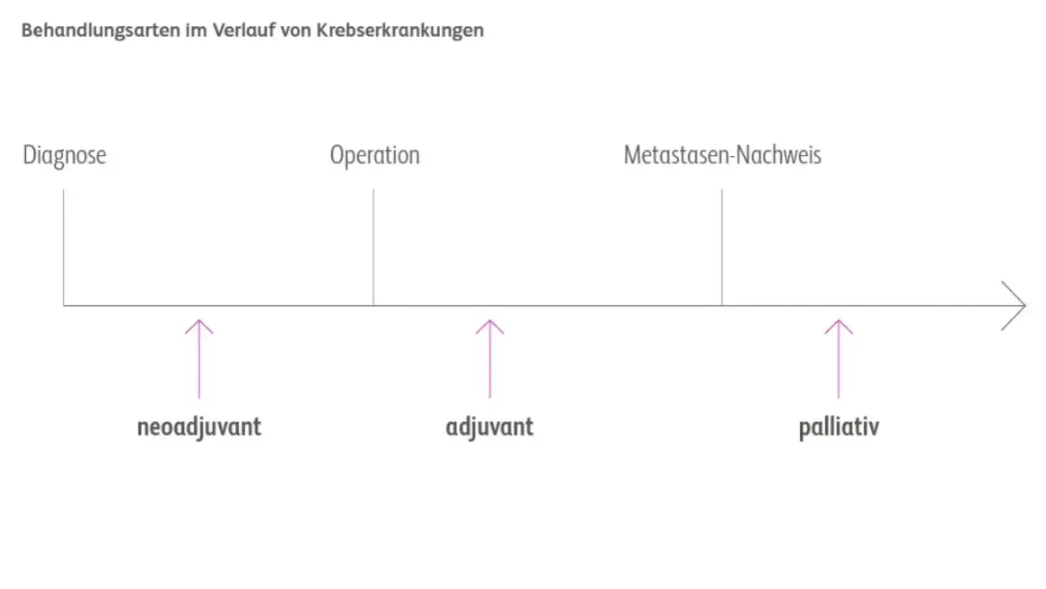 Zeitstrahl zeigt Behandlungsphasen bei Krebs: Diagnose, Operation, Metastasennachweis. Pfeile markieren neoadjuvante, adjuvante und palliative Therapie.
