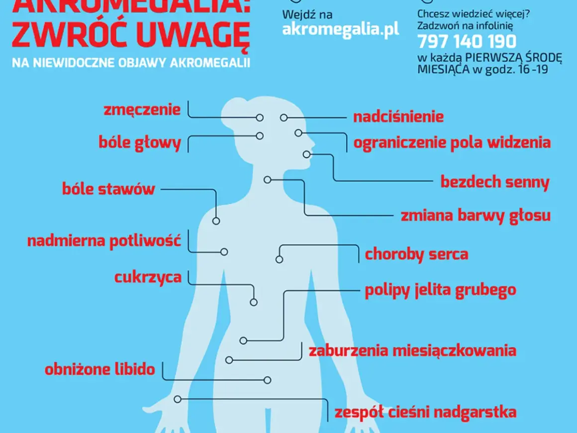 Akromegalia: zmęczenie, bóle głowy, stawów, nadciśnienie, problemy ze wzrokiem, bezdech senny, cukrzyca. Zwróć uwagę na te objawy!