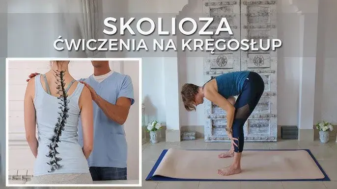 Skolioza: jakich ćwiczeń nie wykonywać, by uniknąć bólu i kontuzji