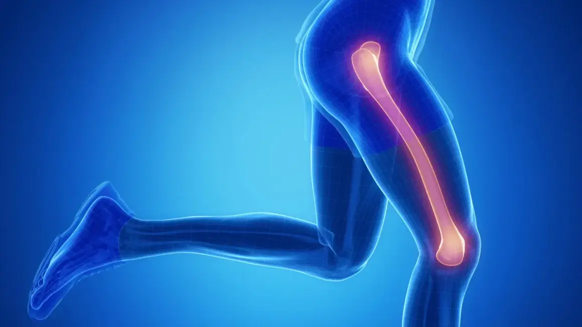 Anatomia nogi z podświetloną kością udową, sugerującą złamanie kości udowej.