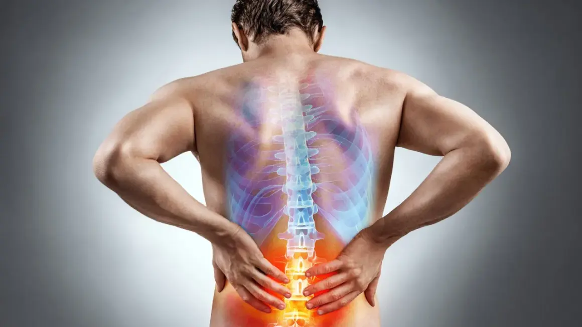 Ból pleców, który może być objawem **sciatica po polsku**. Widoczny kręgosłup z zaznaczonymi obszarami bólu.