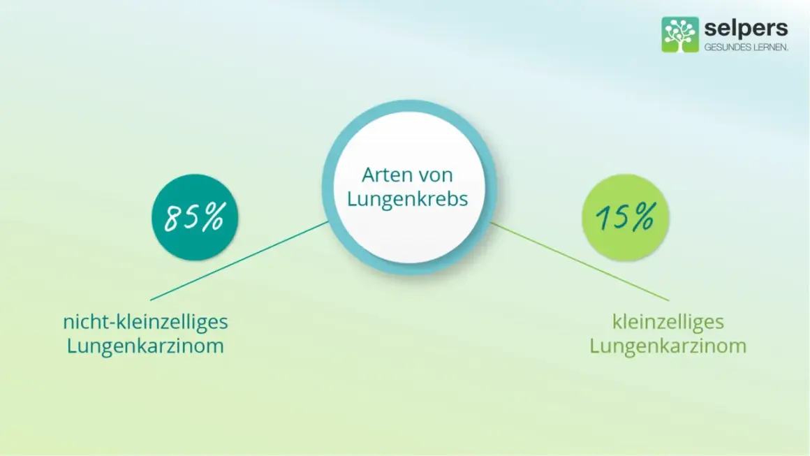 Grafik zeigt Lungenkrebsarten: 85% nicht-kleinzelliges Lungenkarzinom, 15% kleinzelliges Lungenkarzinom.
