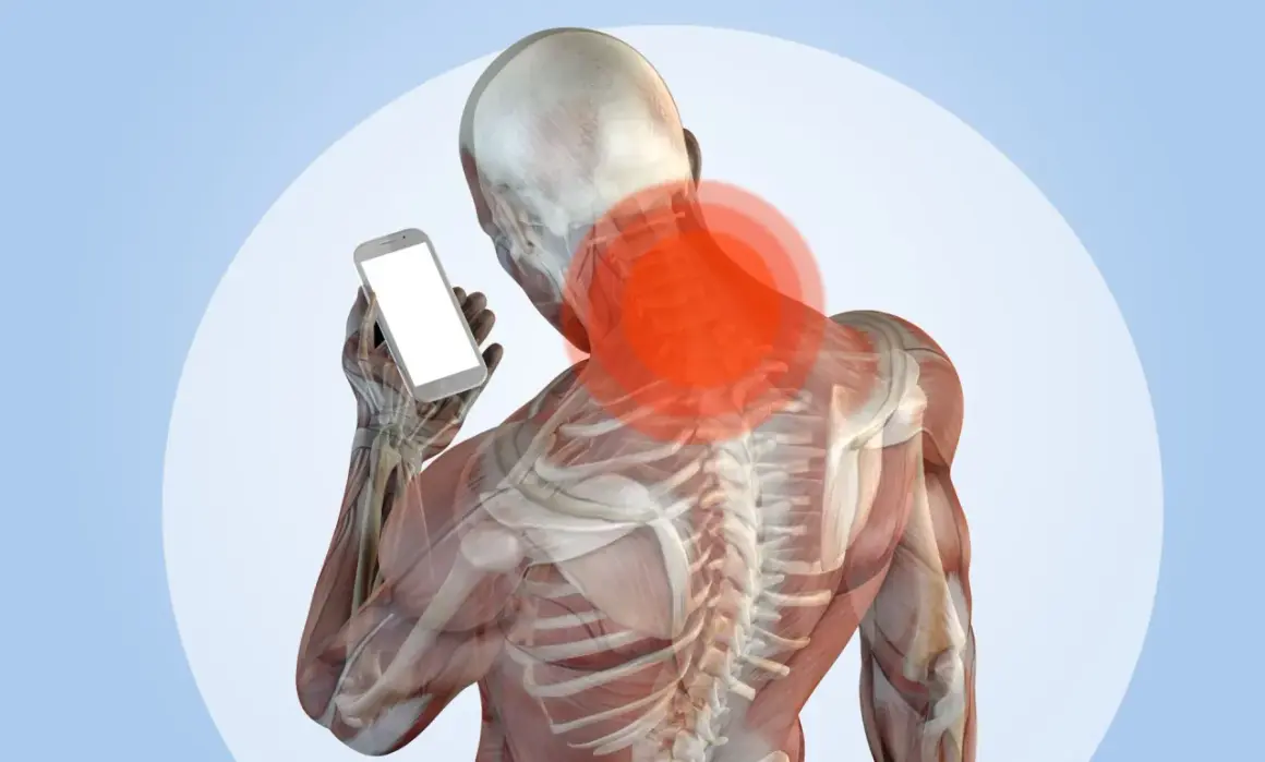 Anatomia del collo con aree rosse di dolore, che illustra il problema del "tech neck" causato dall'uso dello smartphone.
