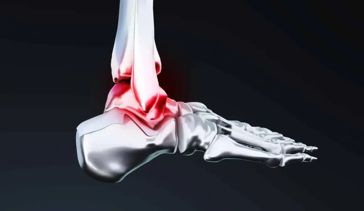 Illustration 3D d'une cheville, montrant la zone rouge de douleur et d'inflammation, essentielle pour la proprioception cheville.