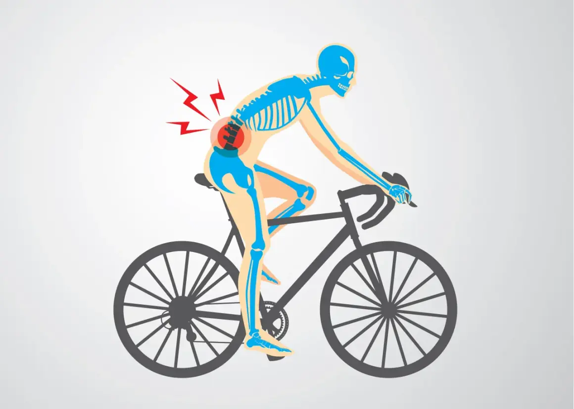 Skelett auf einem Fahrrad mit Schmerzsymbolen im unteren Rückenbereich, das auf Probleme mit der Fahrradergonomie hinweist.