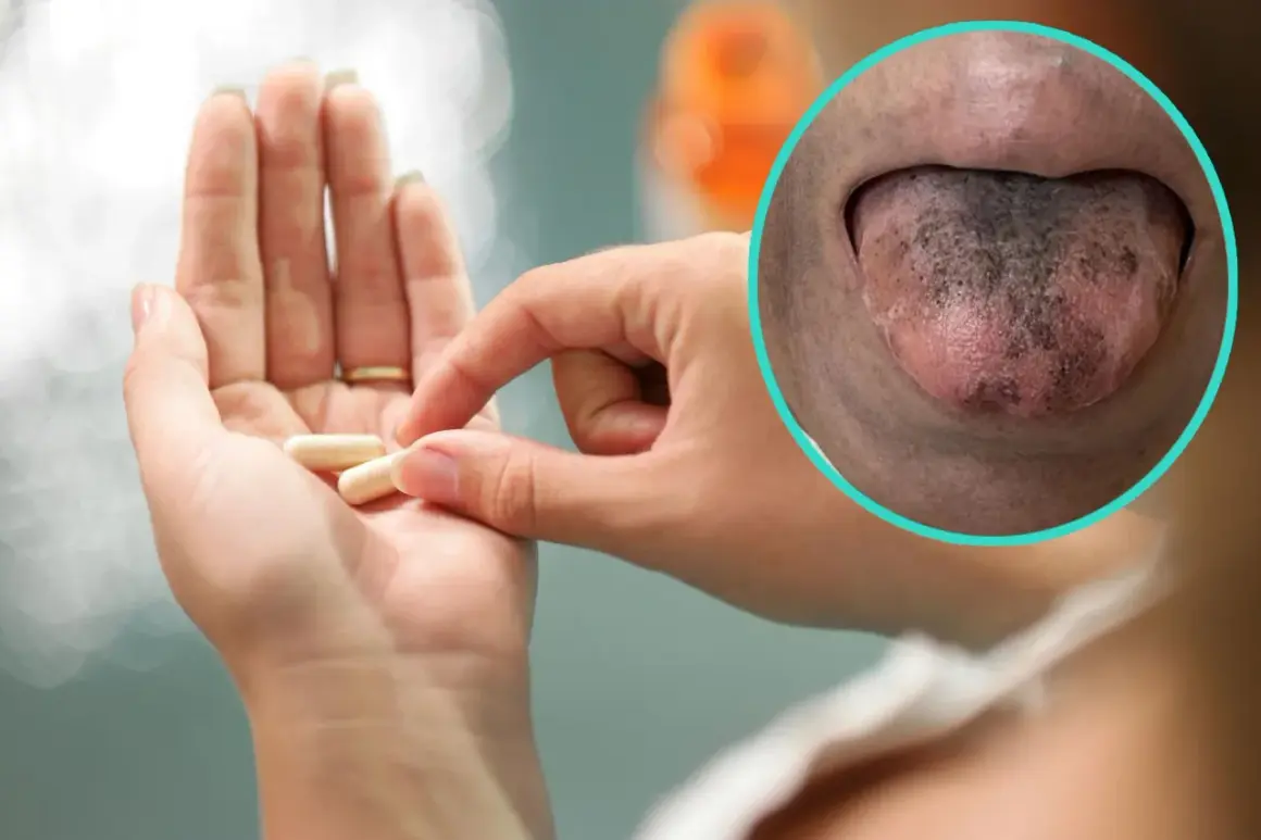 Dłoń z kapsułkami i zbliżenie na czarny język po antybiotyku.