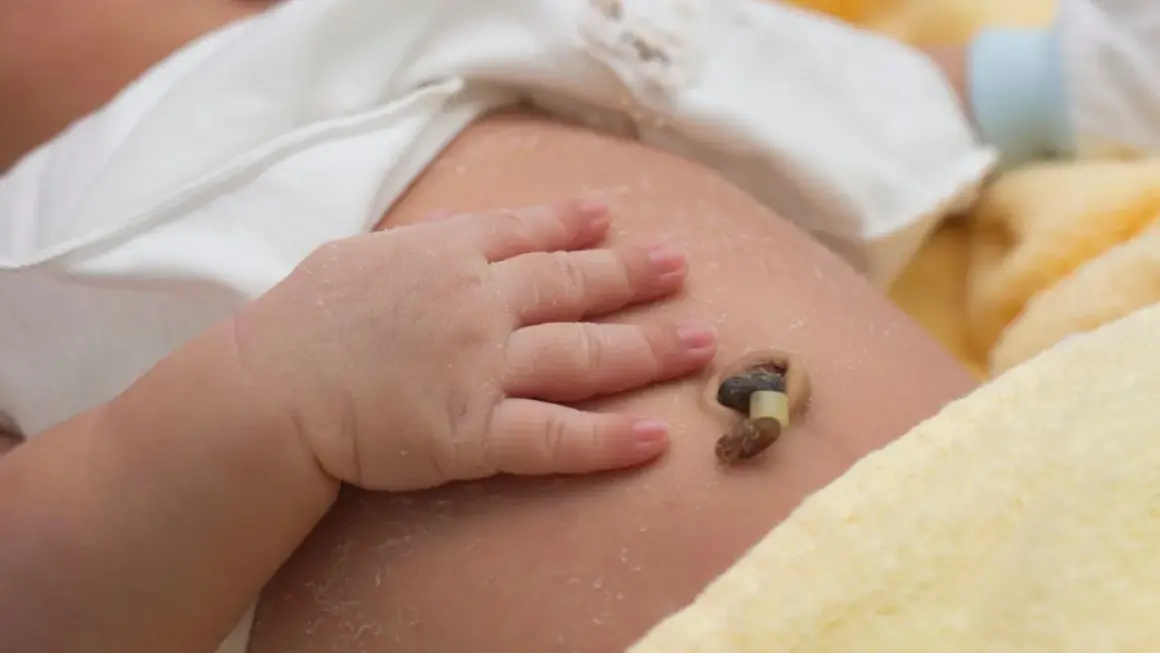 Babybauch mit abgefallener Nabelschnur und leichter Kruste. Ein kleines Babyhändchen liegt daneben.