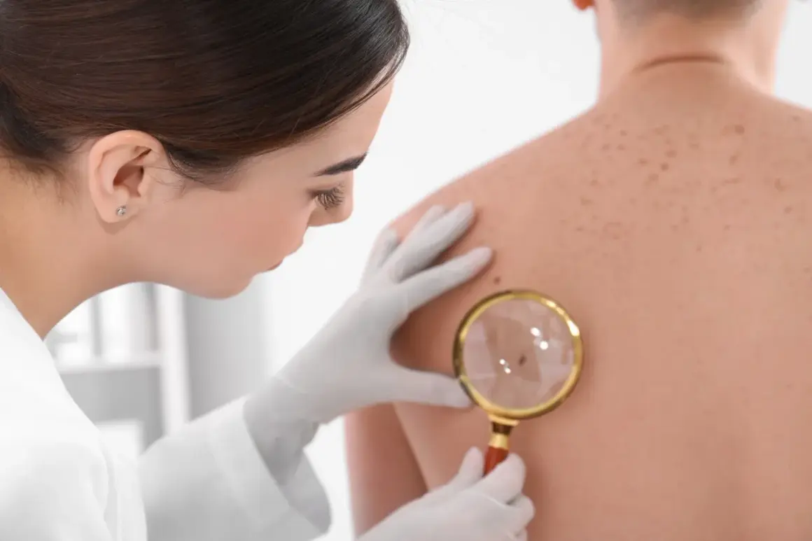 Dermatolog bada plecy pacjenta, skupiając się na jednym, twardym guzkem pod skórą, używając lupy.