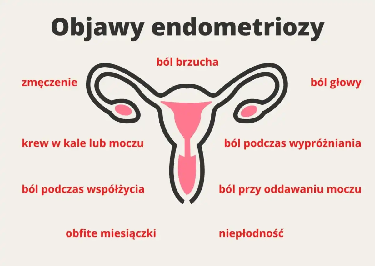 Endometrioza - jak rozpoznać objawy, zanim ból przejmie codzienność