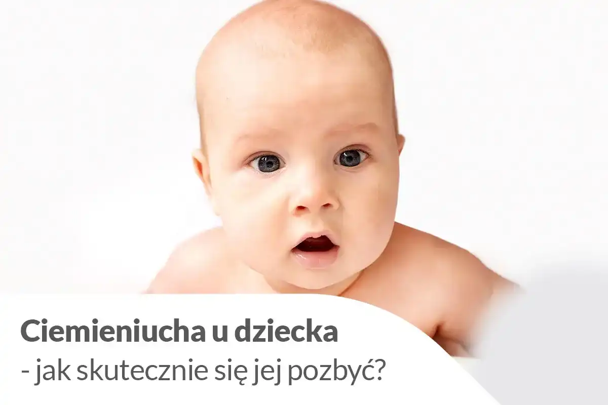 Ciemieniucha u niemowląt - kiedy do lekarza? Poradnik
