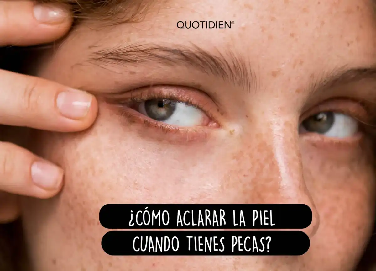 Manchas en la cara - cómo tratarlas sin irritar la piel