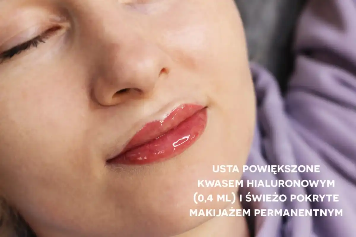 Wygojony makijaż permanentny ust - Co musisz wiedzieć?