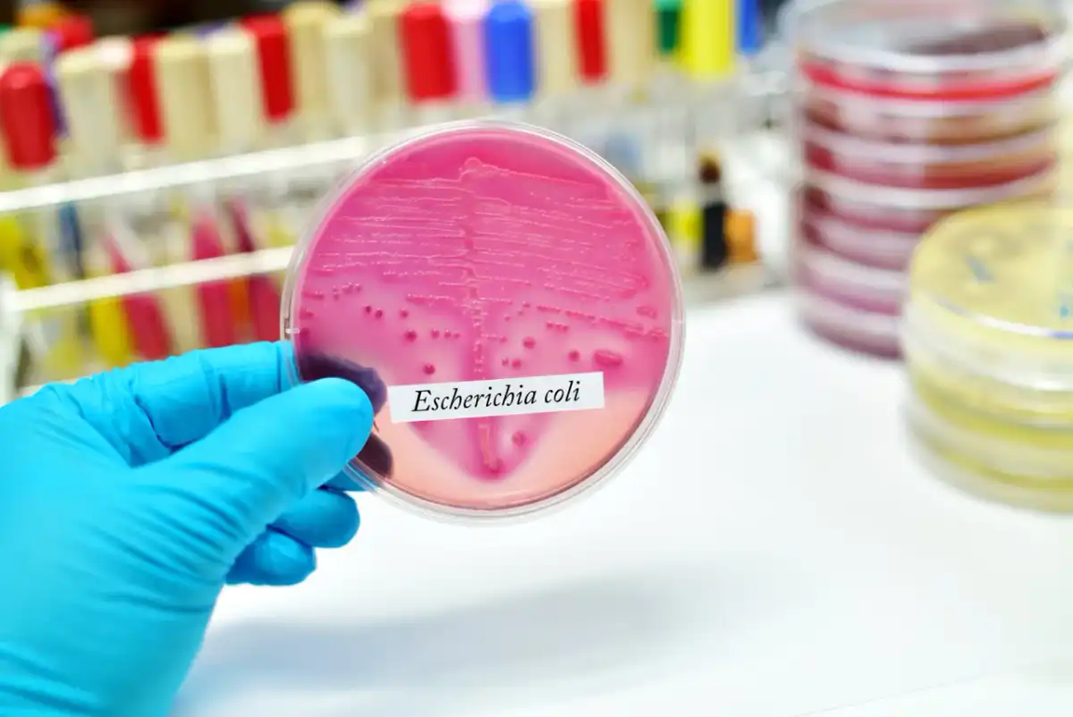 E. coli - choroby, objawy i kiedy pilnie skonsultować się z lekarzem