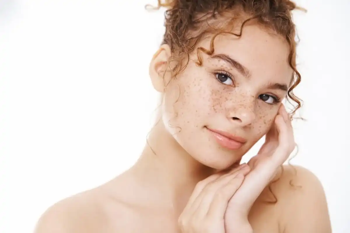 Pecas en la cara, qué significan y cómo cuidarlas