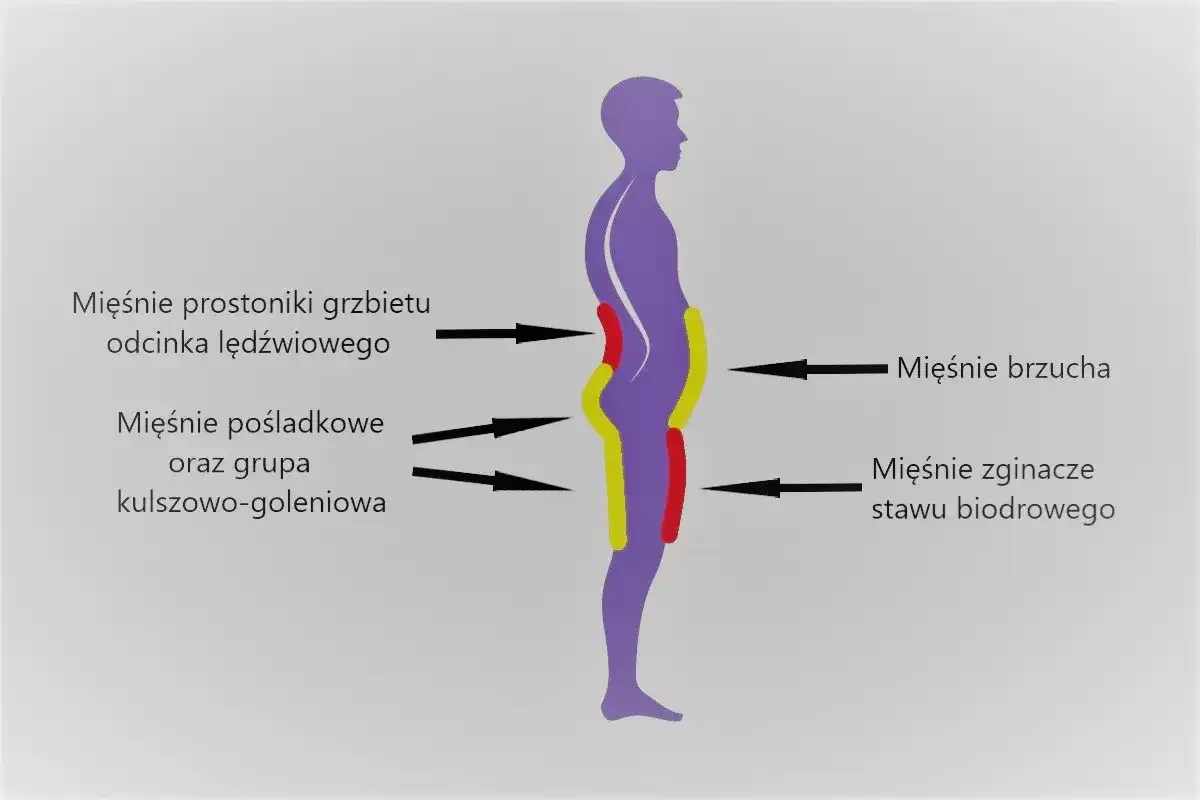 Hiperlordoza lędźwiowa - Jak leczyć i kiedy do fizjoterapeuty?