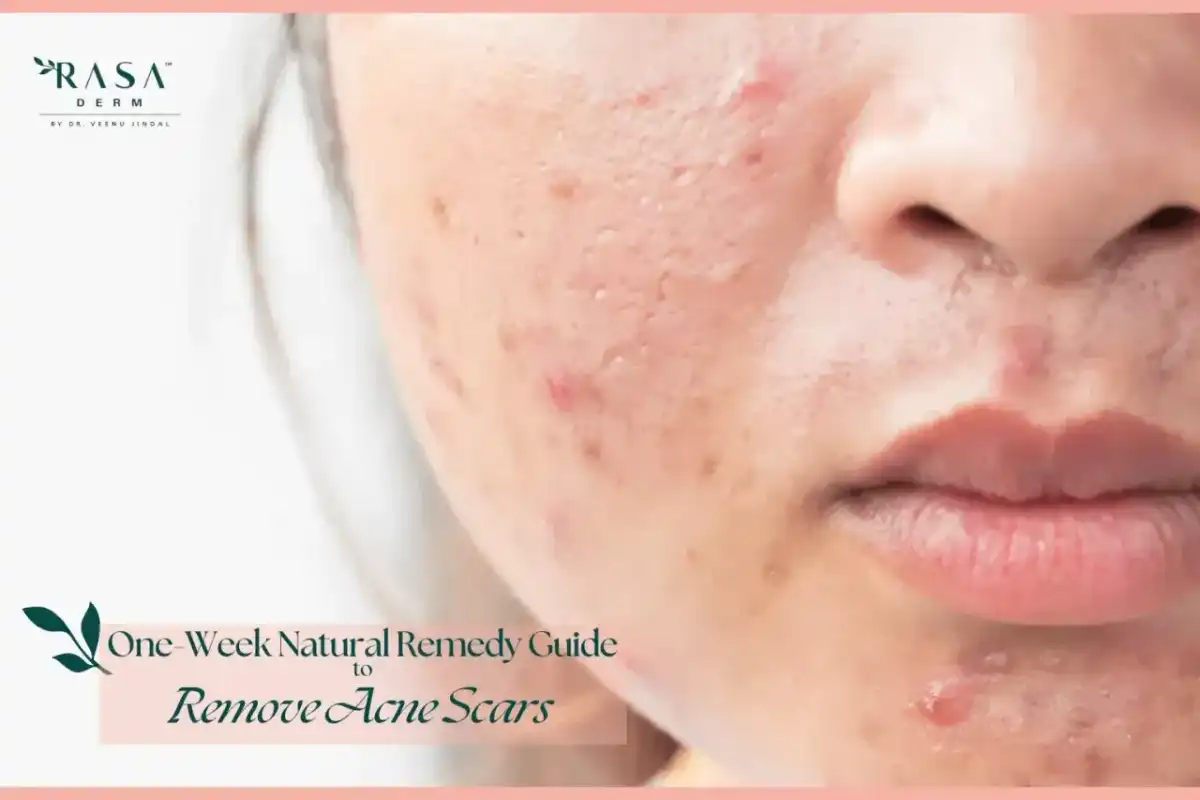 Kaszka na twarzy - Co naprawdę działa i kiedy do dermatologa?
