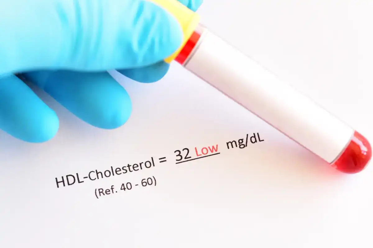 Pitamet - lek na cholesterol: jak działa i kiedy go stosować?