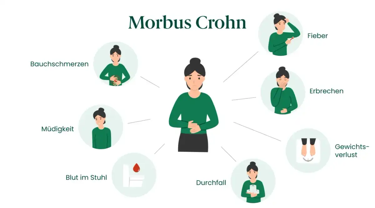 Morbus Crohn bei Frauen - die wichtigsten Anzeichen erkennen