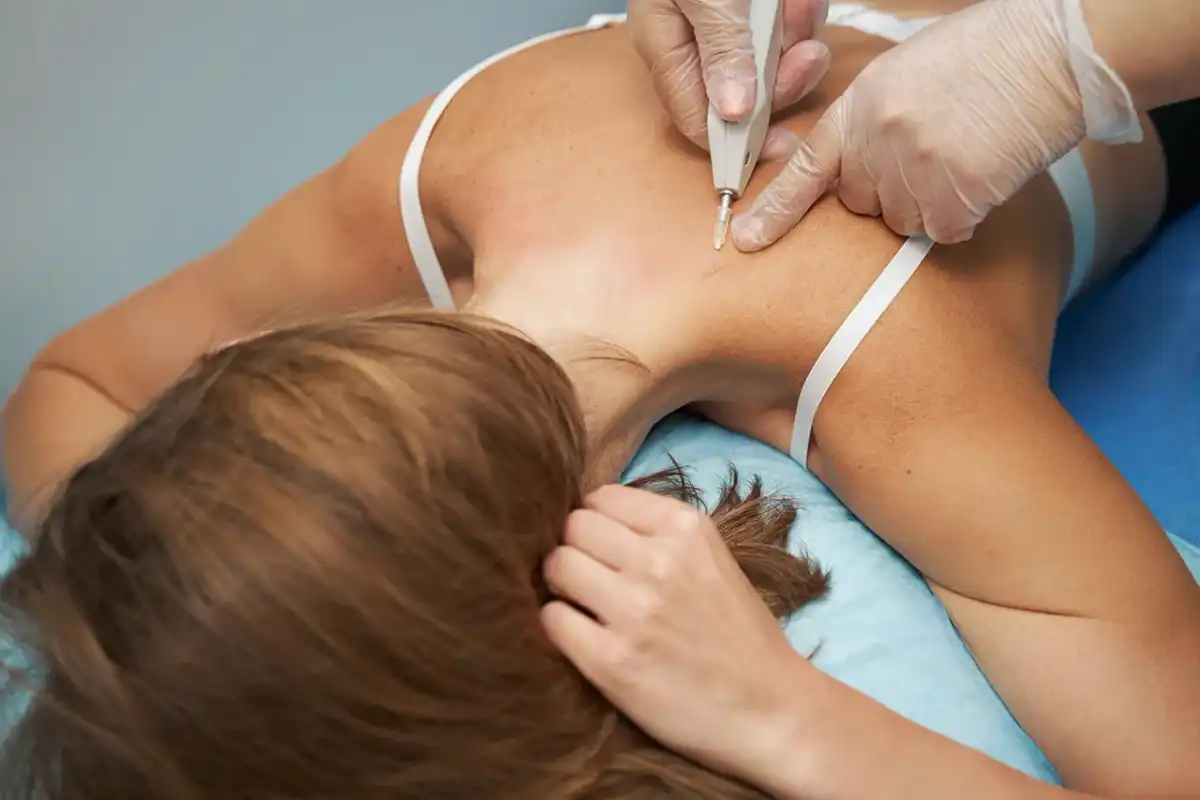 Carboxiterapia Corporal - ¿Funciona? Precios y Claves antes de Elegir