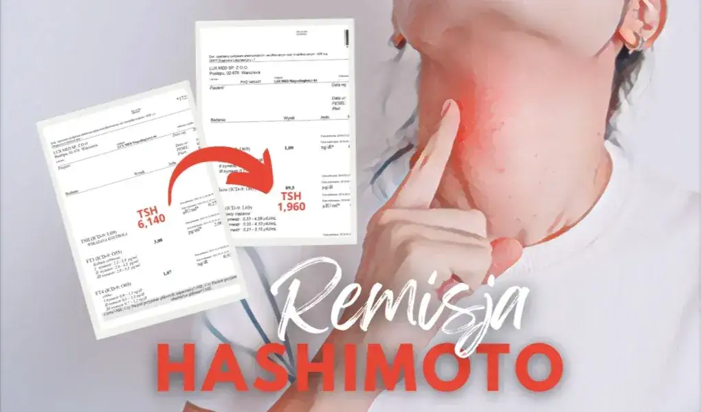 Czy choroba Hashimoto kwalifikuje do renty? Sprawdź kryteria i możliwości
