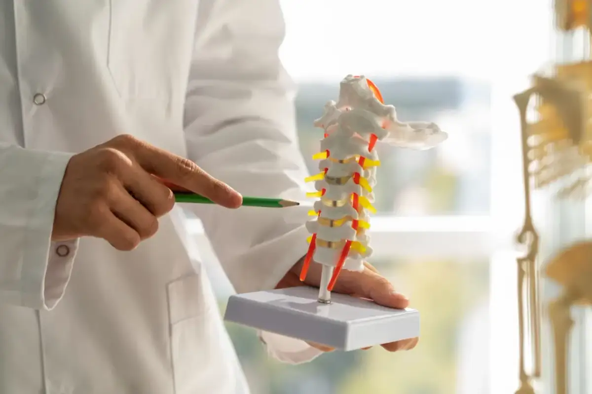 Lekarz wskazuje na model kręgosłupa szyjnego, gdzie widoczne są osteofity na krawędziach trzonów kręgów.
