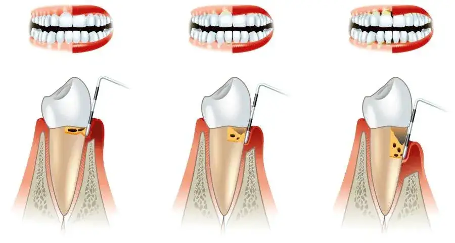 Periodontolog: Kiedy iść z dziąsłami? Przewodnik po specjalistach
