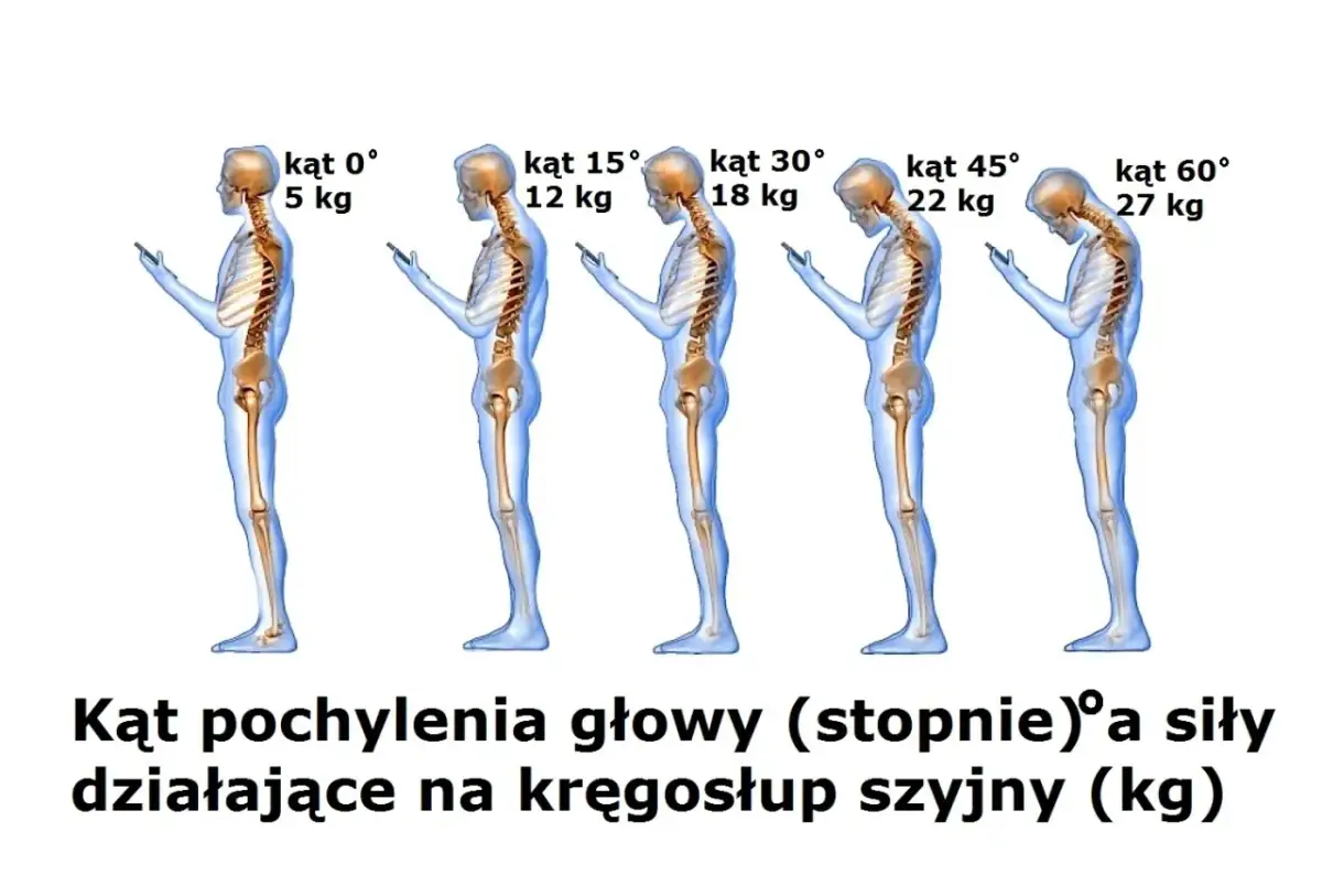 Schylanie się nad telefonem obciąża kręgosłup szyjny. Im większy kąt pochylenia głowy, tym większa siła działa na szyję.