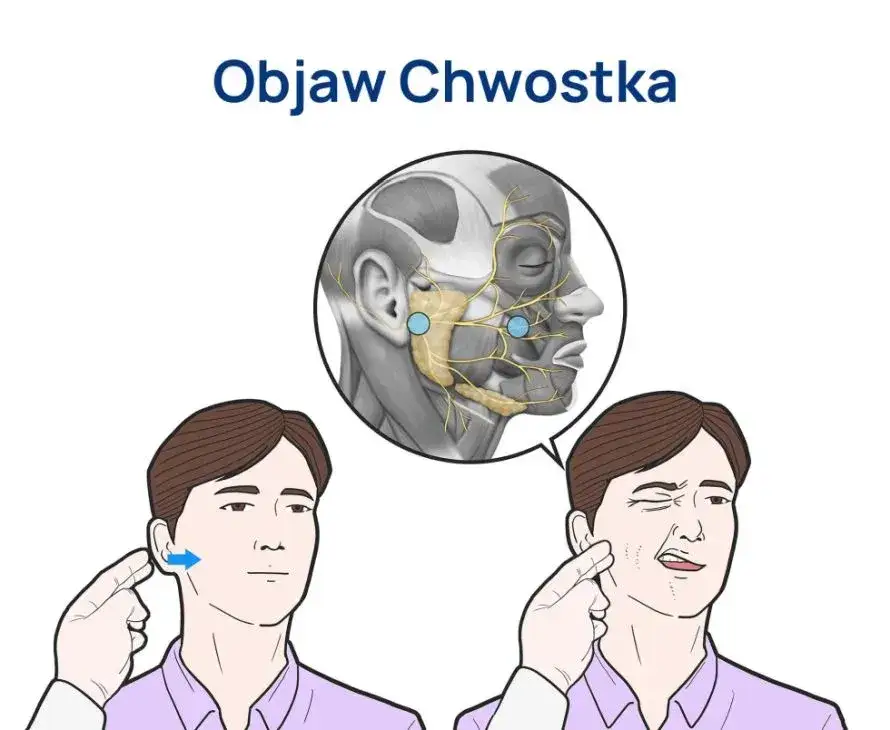 Tężyczka a nerwica: objawy psychiczne, diagnoza i leczenie