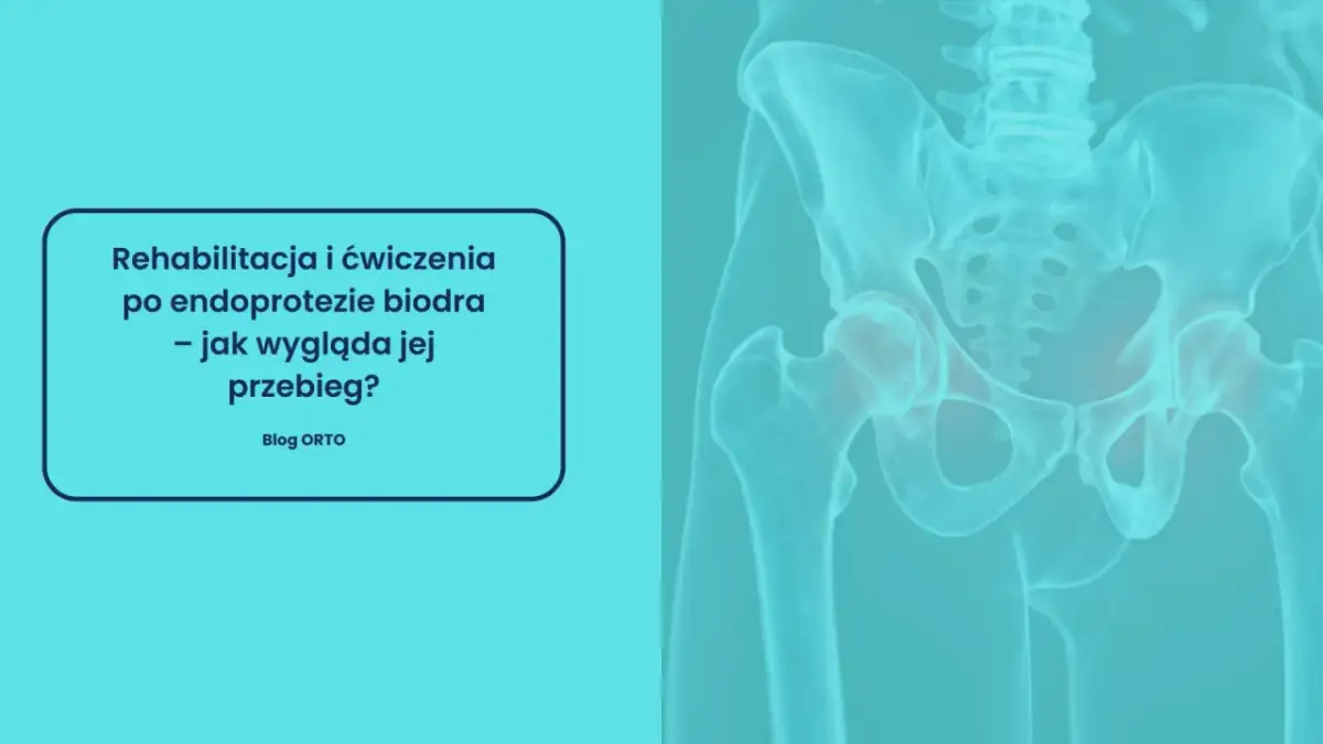 Rehabilitacja po endoprotezie biodra. Grafika przedstawia miednicę z zaznaczonymi stawami biodrowymi, sugerując przykurcz biodra.