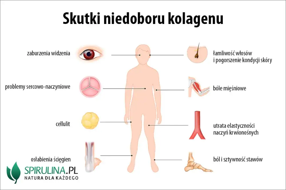 Objawy niedoboru kolagenu: Rozpoznaj i skutecznie uzupełnij!