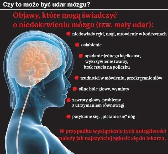 Zmiany malacyjne w mózgu objawy – jak je rozpoznać i co oznaczają?