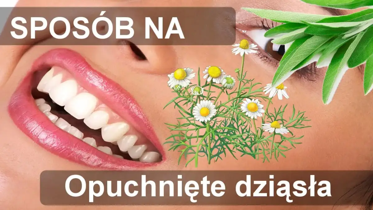 Opuchnięte dziąsła: Szybka ulga i skuteczne sposoby (domowe i apteczne)