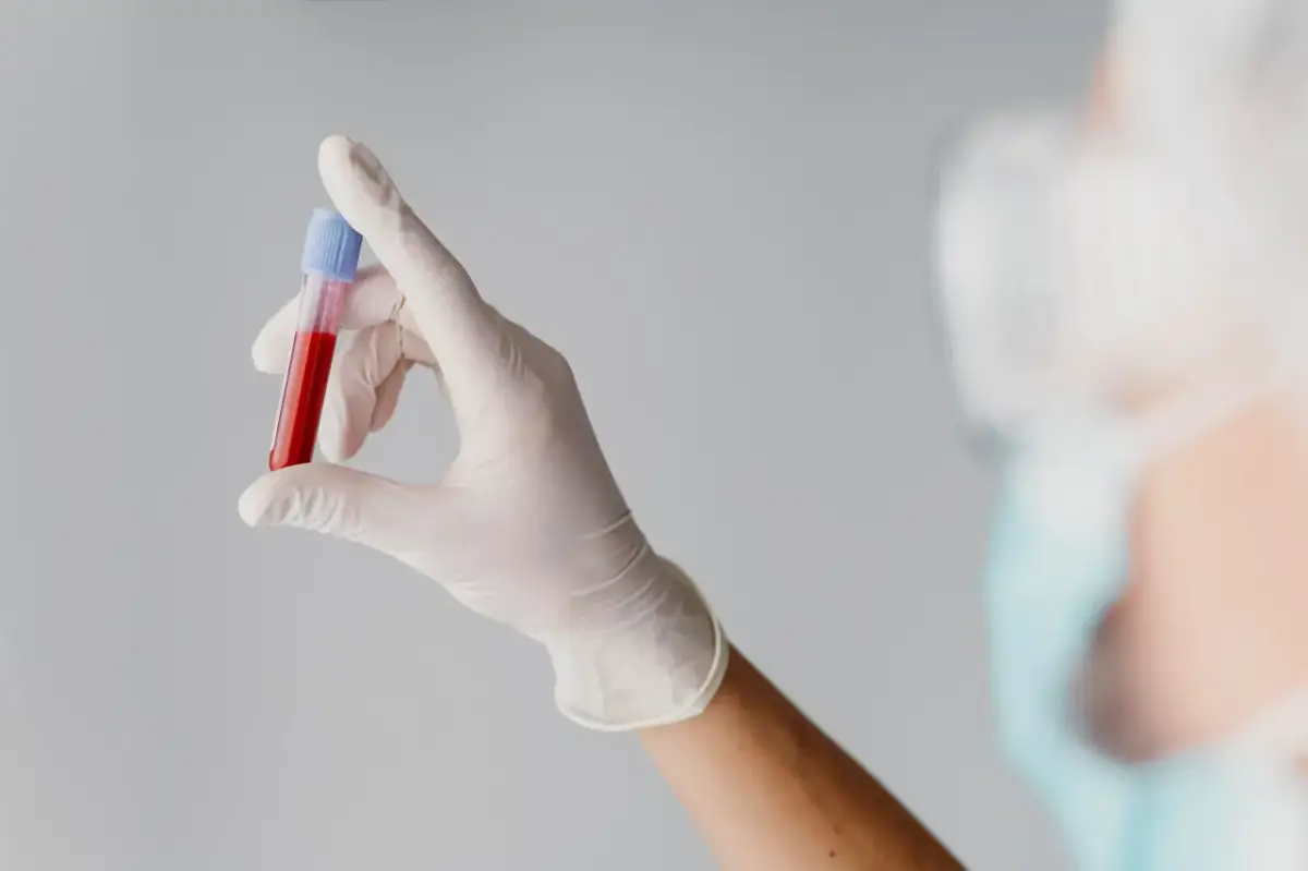 Ręka w białej rękawiczce trzyma probówkę z krwią do badań, np. mchc.