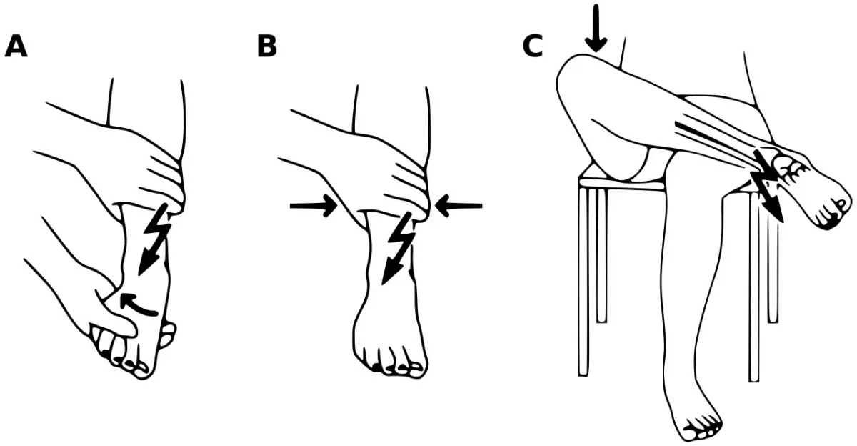 Ilustracje A, B, C pokazują zastosowanie zasady PRICE w leczeniu urazów: P - ochrona, R - odpoczynek, I - lod, C - ucisk, E - elewacja.