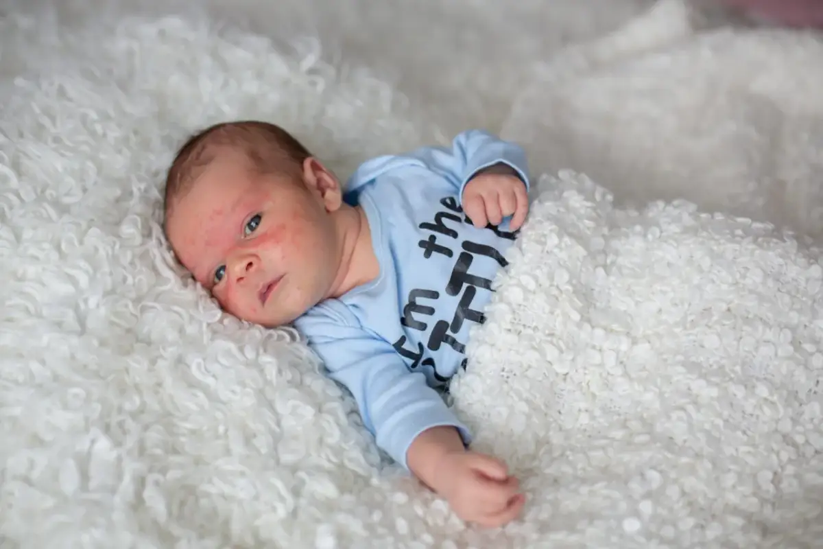 Alergia na bmk u niemowlaka objawy - jak je rozpoznać i zareagować